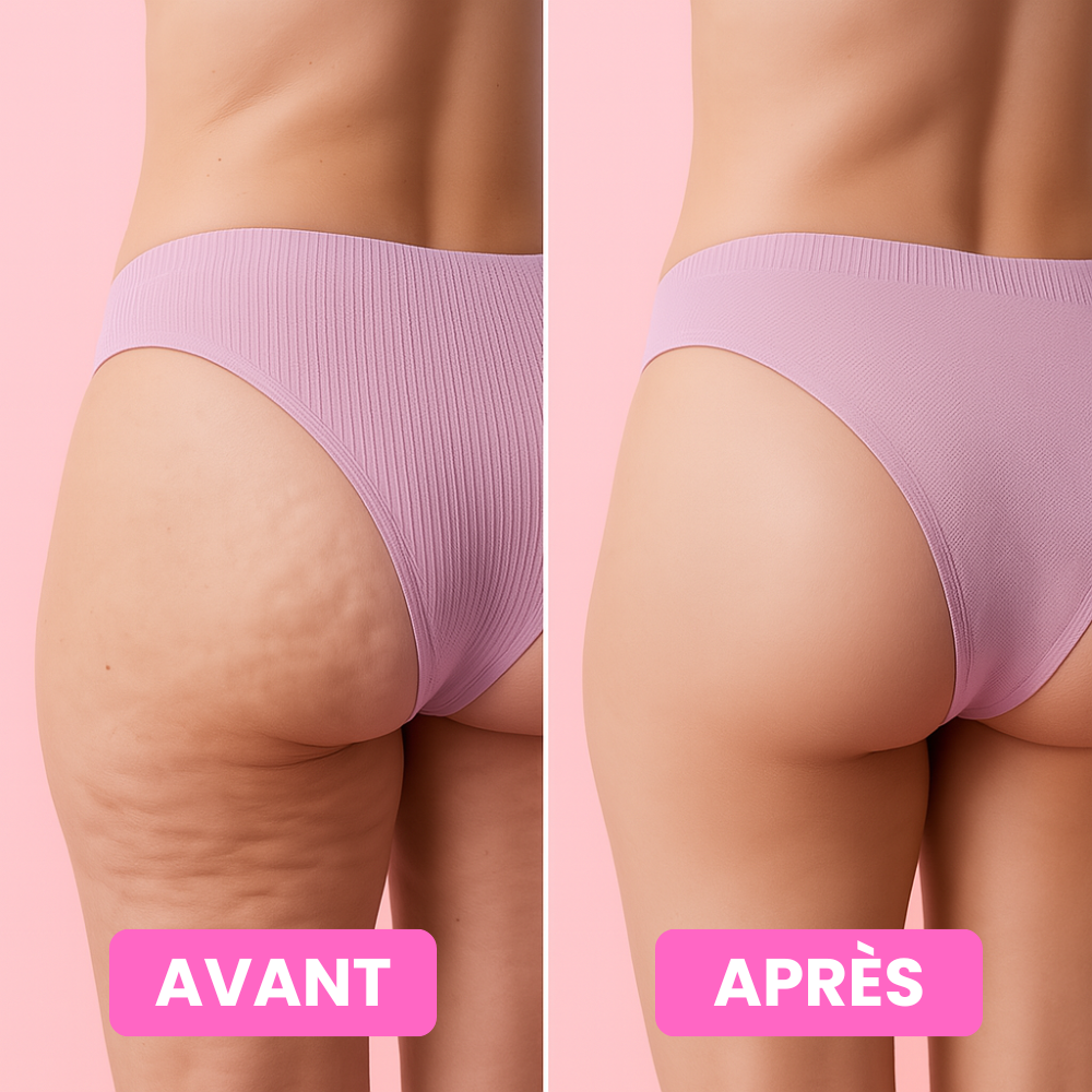 Crème 100% Naturelle Anti-Cellulite Slimélya®